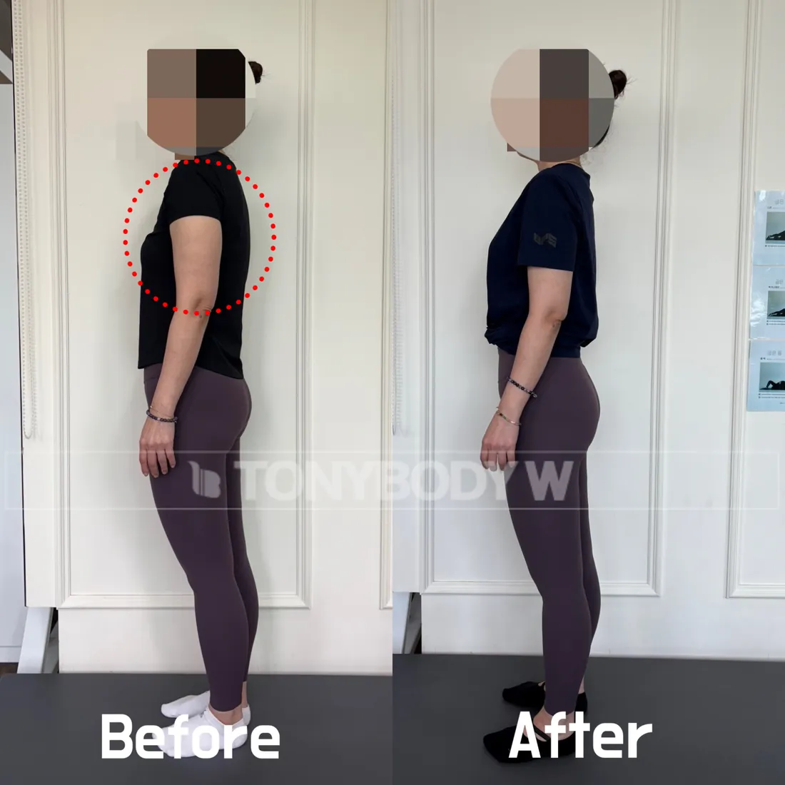 토니바디W우먼 회원 변화 전후 사진 7